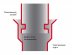 Дымоход Шидель Permeter 25 комплект для насадного монтажа